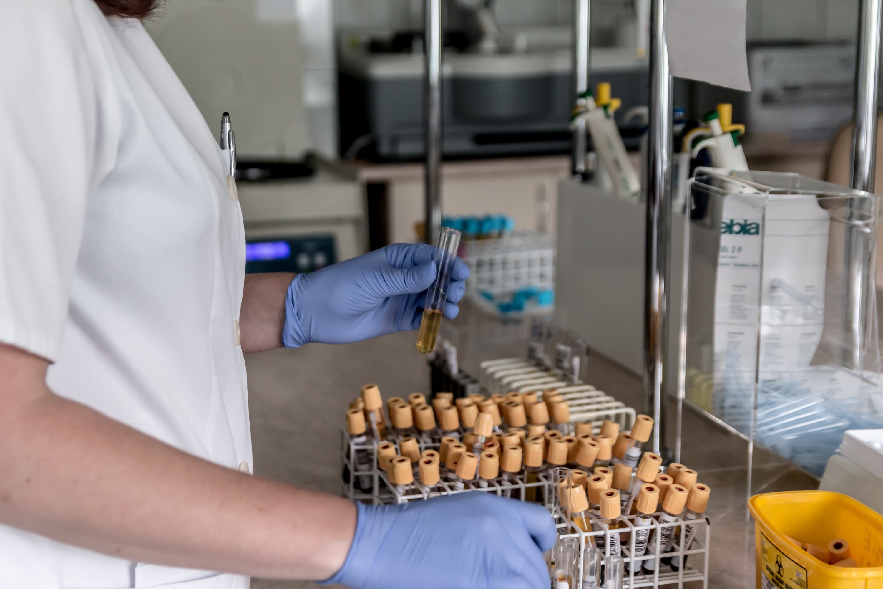 A laboratory professional handling a patient sample